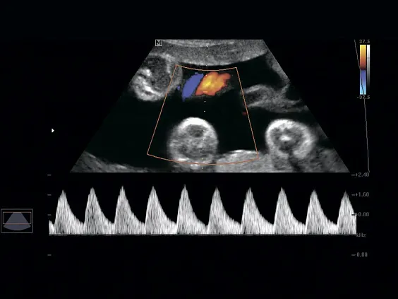 Клинические изображения УЗИ аппарат НПО Сканер РуСкан 50