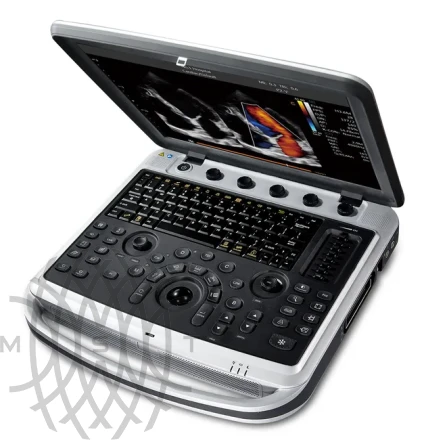 УЗИ аппарат Chison SonoTouch 80 портативный