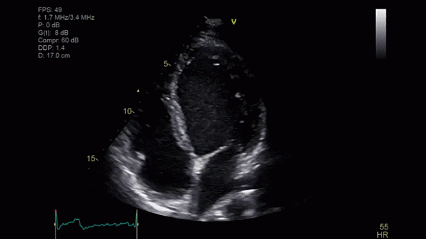 Клинические изображения Ультразвуковая диагностическая система GE HealthCare Vivid iQ портативная