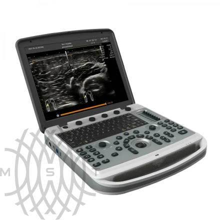 УЗИ аппарат Chison SonoTouch 80 Expert портативный