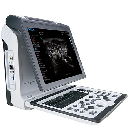 SIUI Apogee 1100 УЗИ аппарат портативный