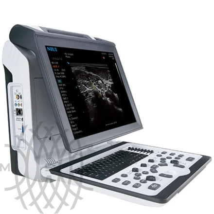 SIUI Apogee 1100 УЗИ аппарат портативный
