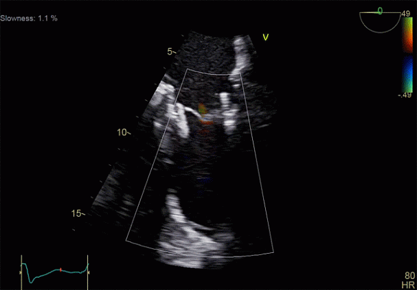 Клинические изображения Ультразвуковая диагностическая система GE HealthCare Vivid E95
