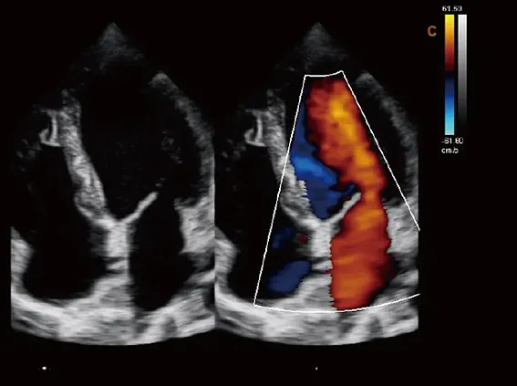 Клинические изображения УЗИ аппарат Chison SonoTouch 80 Expert портативный