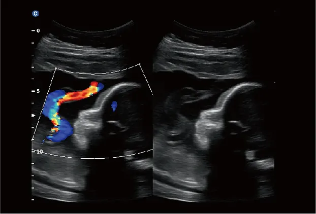 Клинические изображения УЗИ аппарат Chison SonoTouch 60 портативный