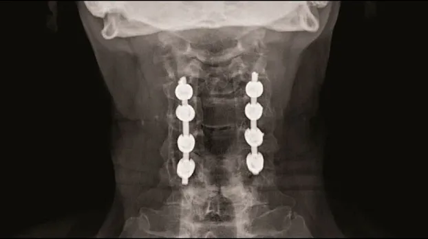 Клинические изображения Цифровой рентгеноcкопический аппарат GE Discovery RF180