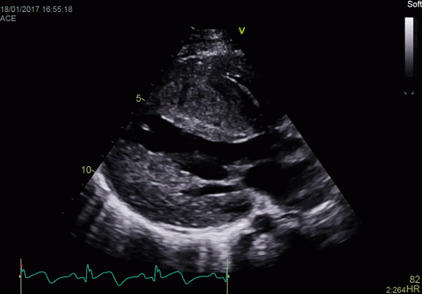 Клинические изображения УЗИ аппарат GE HealthCareVivid E90