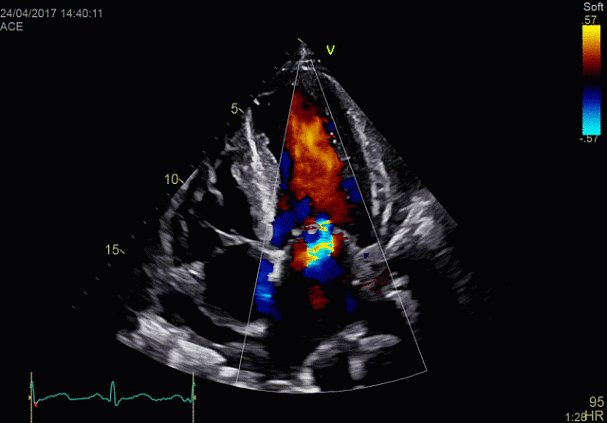 Клинические изображения УЗИ аппарат GE HealthCareVivid E90
