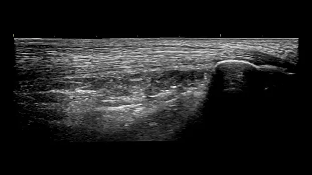 Клинические изображения GE HealthCare Versana Balance УЗИ аппарат