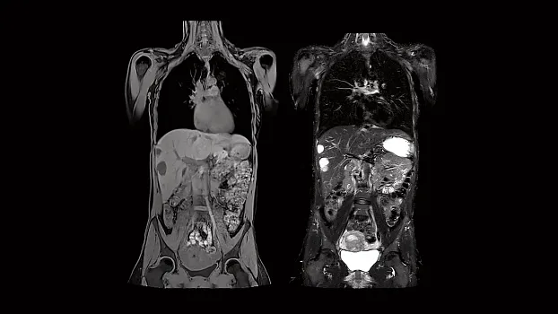 Клинические изображения МРТ аппарат Siemens Magnetom Sola 1,5T