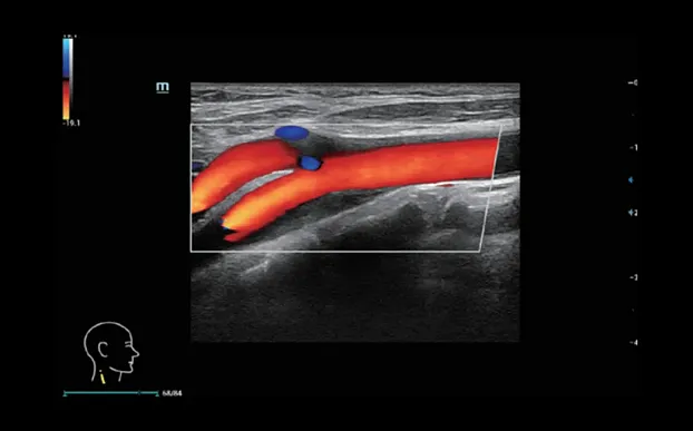 Клинические изображения УЗИ аппарат Mindray Resona i9