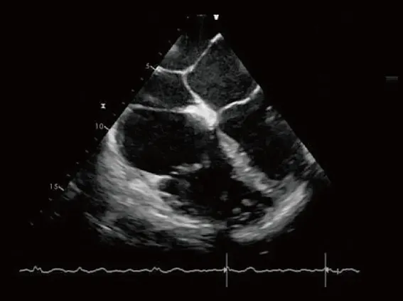 Клинические изображения УЗИ аппарат Chison SonoTouch 80 Expert портативный