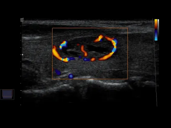 Клинические изображения УЗИ аппарат НПО Сканер РуСкан 50